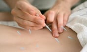 Medicare to Pay for Acupuncture for Lower Back Pain
